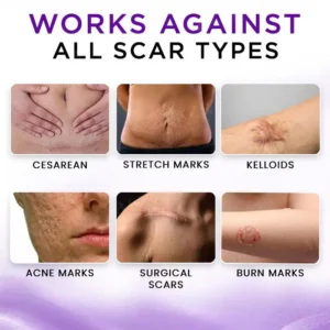 AEXZR® Cure Face & Body Scar Gel