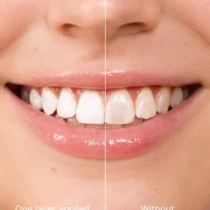 LOVILDS™ Tooth Polish - Instant Whitening for a Sparkling Smile