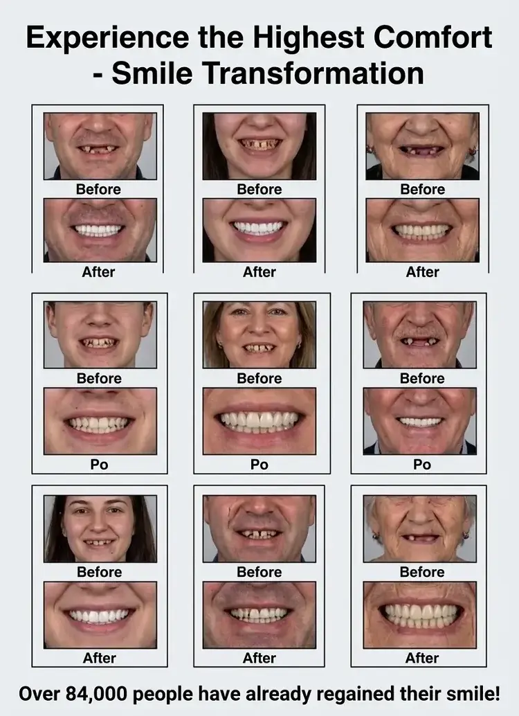 🏆Ends Today: 70% OFF! 🏆2026 Bestselling Product🦷 Fit for a Fresh Smile, Say Goodbye to Wearing Discomfort!
